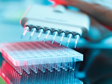 NfL as disease biomarker