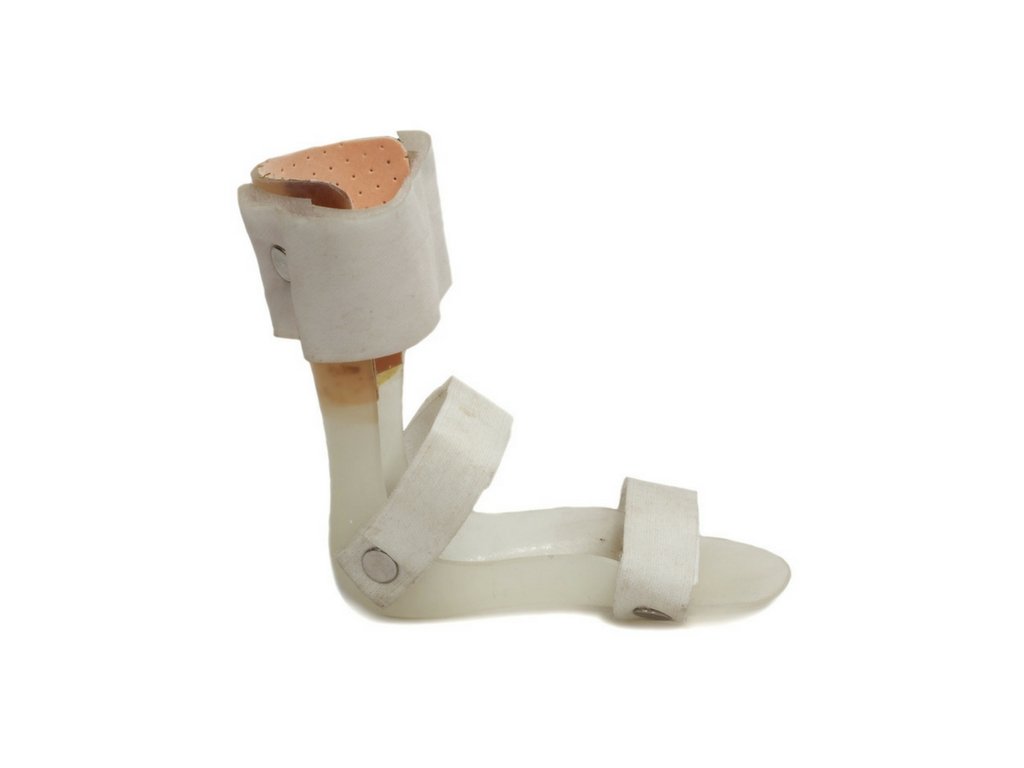 use of orthoses