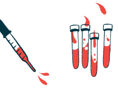 irisin Hormone | Charcot-Marie-Tooth News | illustration of vials containing blood